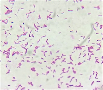 A case of melioidosis with hemoptysis: Strategies to isolate and ...